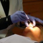 Impianti dentali a carico immediato: tornare a sorridere in 24 ore